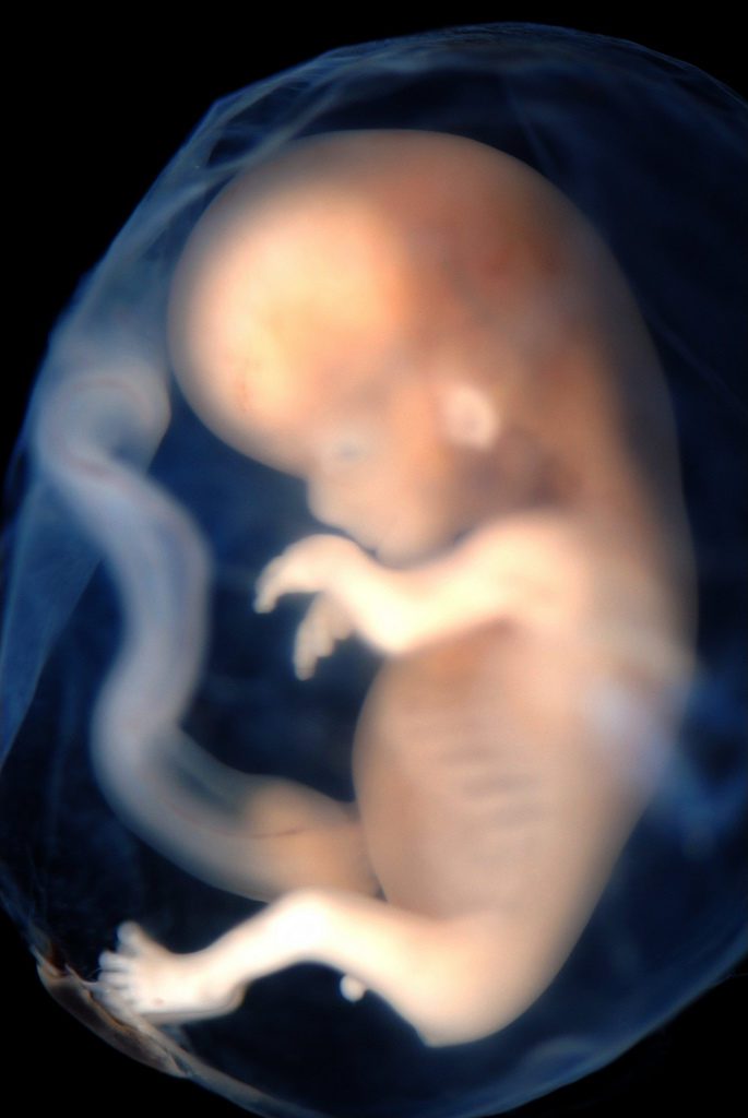 Life begins at fertilization. Thanks, Science!