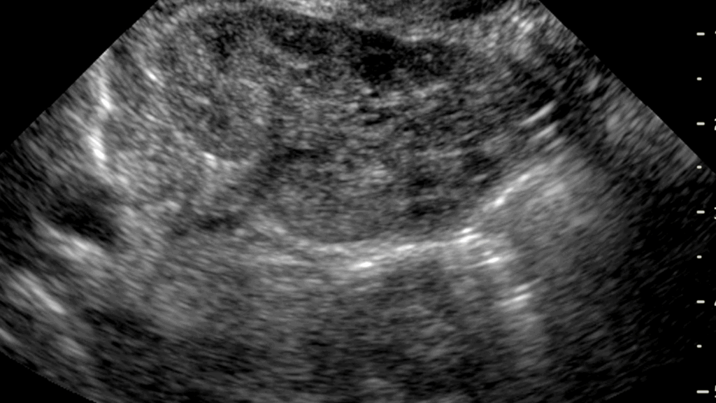 Becerra Would Be a Radical Pro-Abortion Warrior at HHS